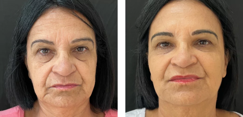 98967936-65e08f1e0c42d