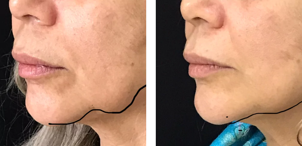 98967939-65e08f1c92ad3